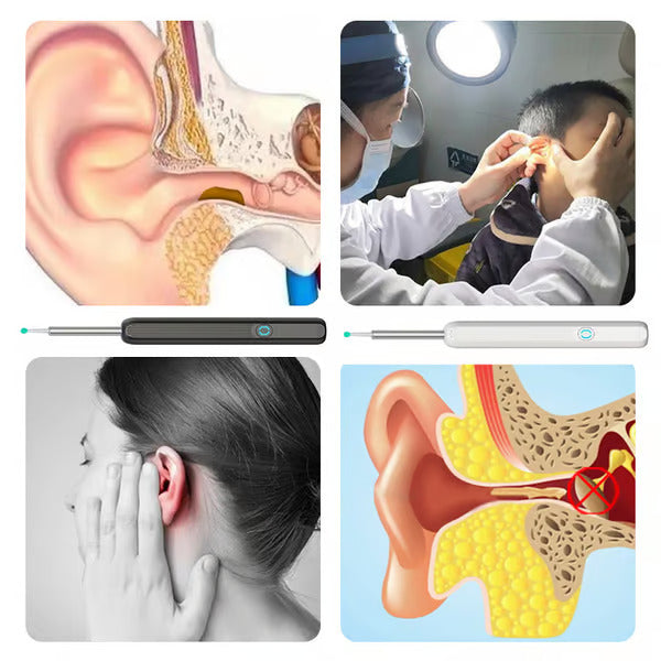 Easy Ear Cleaner 8 Pcs Ear Set with Camera