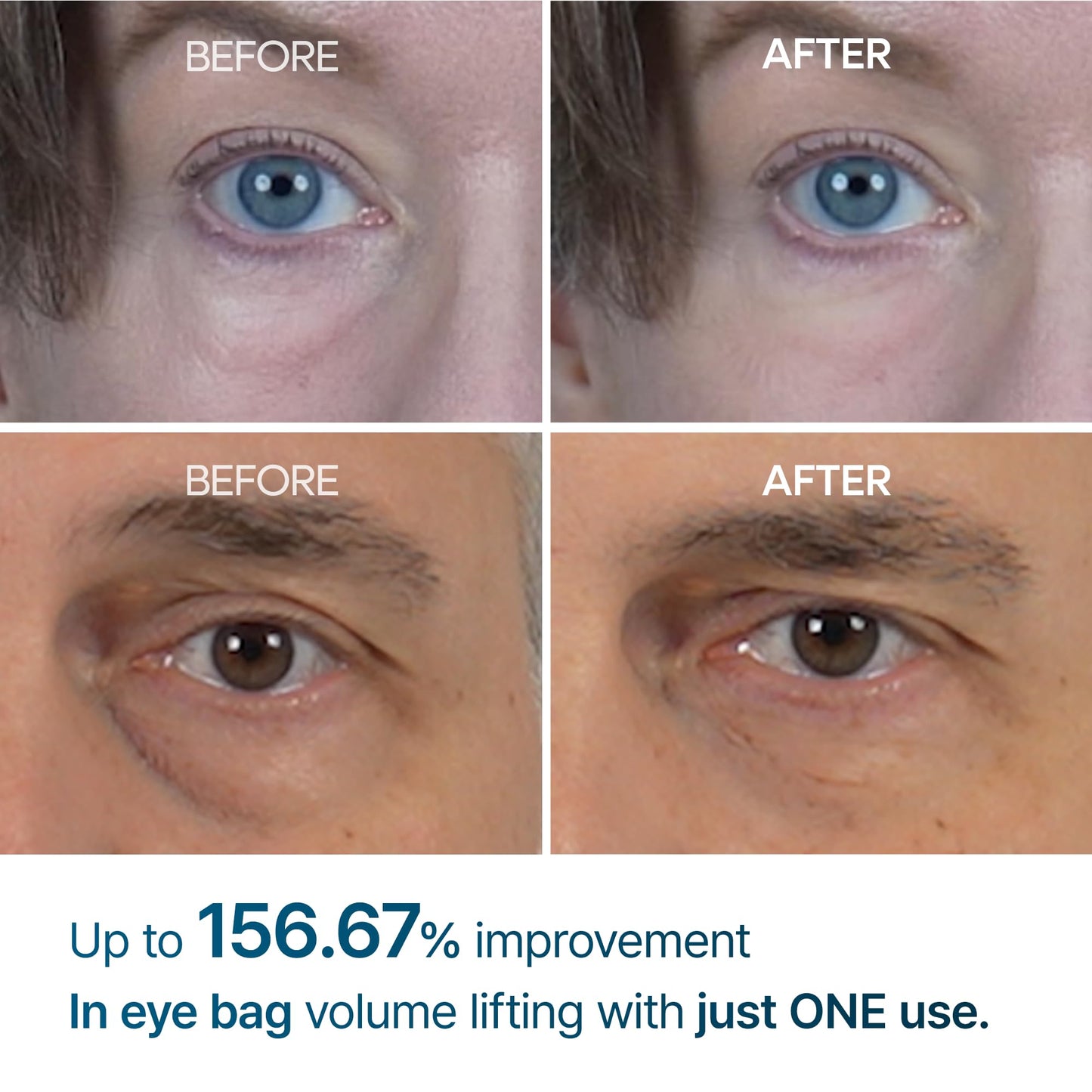 Dr. Melaxin Anti-Eyebag cream